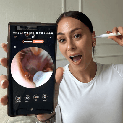 אוזן קלין - מנקה אוזניים עם מצלמה