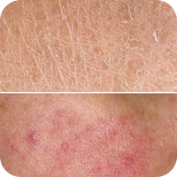 😣 נזק לעור